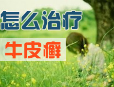 牛皮癣能治好吗