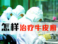 牛皮癣怎样治疗有疗效