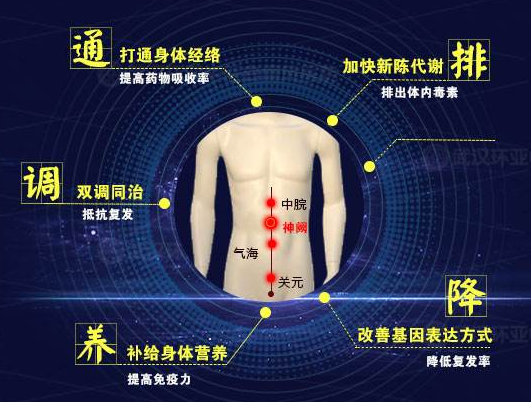 脐穴药离子导入疗法